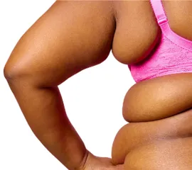 Тирзепатид